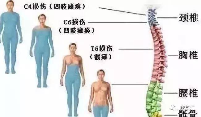 脊髓损伤最新进展,脊髓损伤最新进展研究及治疗策略探讨